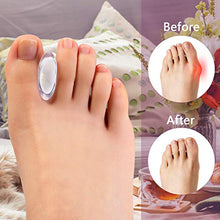 Load image into Gallery viewer, Promifun Gel Toe Separators to Straighten Overlapping Toes, 12 Packs of Toe Spacers for Bunion and Corns, Corrector Pads for Crooked Toes, Calluses, Bunions