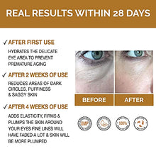 Load image into Gallery viewer, π£π₯ππ ππ¨π Anti Ageing Eye Serum / Eye Cream for Dark Circles, Puffiness & Crows Feet - Anti Wrinkle Eye Serum - Reduces Wrinkles, Bags, Saggy Skin & Puffy Eyes! High Quality Eye Cream. Q10 & Matrixyl 3000. Over 500,000 Happy Customers Worldwide
