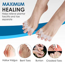 Load image into Gallery viewer, Toe Separators for Overlapping Toes, Gel Silicone Toe Straightener Corrector, Toe Spreader Spacers for Hallux Valgus Tailors Claw and Crooked Toes