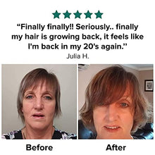 Load image into Gallery viewer, Moerie Ultimate Mineral Hair Growth Spray – For Longer, Thicker, Fuller Hair - with Biotin & Caffeine - Vegan Hair Products – Paraben Free – All Hair Types – Reverse Hair Loss