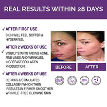 Load image into Gallery viewer, PREMIUM Retinol Serum For Face/Neck/Eyes with Hyaluronic Acid. 8X More Effective, Anti Ageing Retinol Serum for Acne Treatment, Wrinkles, Fine Lines & Sensitive Skin, Hydrate & Brighten your look! 100% Satisfaction