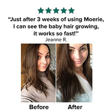 Load image into Gallery viewer, Moerie Ultimate Mineral Hair Growth Spray – For Longer, Thicker, Fuller Hair - with Biotin & Caffeine - Vegan Hair Products – Paraben Free – All Hair Types – Reverse Hair Loss