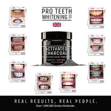 Load image into Gallery viewer, yellow teeth treatment