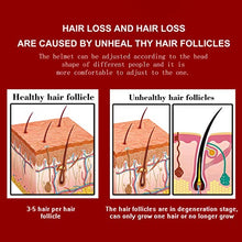 Load image into Gallery viewer, Laser Hair Growth Therapy Cap (LLLT),108 Lasers for Hair Loss Treatment for Men and Women,Stimulate Hair Growth, Regrow, Add Density, Get Thicker, Fuller Hair (Black)