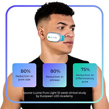 Load image into Gallery viewer, LUSTRE ClearSkin Solo - Blue Light Acne Treatment Device, UV-Free & Wireless | LED Therapy for Face and Body Acne, Spots and Blemishes | Prevent breakouts, inflammation and Skin Redness | No Chemicals