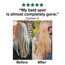 Load image into Gallery viewer, Moerie Ultimate Mineral Hair Growth Spray – For Longer, Thicker, Fuller Hair - with Biotin & Caffeine - Vegan Hair Products – Paraben Free – All Hair Types – Reverse Hair Loss
