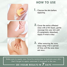 Load image into Gallery viewer, Butt Acne Clearing Treatment Cream Thigh Acne Treatment Cream Pure Natural Plant ingredients Clears Acne and Pimples For Bum Cream Keep Buttocks Skin Smooth with Salicylic Acid
