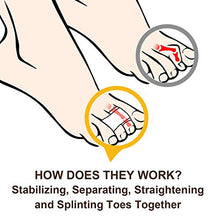 Load image into Gallery viewer, Welnove 6Pcs Hammer Toe Straightener, Hammer Toe Splints, Toe Cushioned Bandages for Correcting Hammer Toes, Broken Toes, Crooked Toes & Overlapping Toes