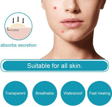 Load image into Gallery viewer, Acne Pimple Patches Acne Spot Treatments Hydrocolloid Patches Invisible Spot & Blemish Acne Stickers 144 Patches