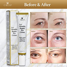 Load image into Gallery viewer, Rapid Wrinkle Repair Eye Cream - Anti-Aging Under Eye Treatment - Instant Results Depuffing Eye Cream - Remove Dark Circles & Bags Under Eyes - Fights Wrinkles & Fine Lines - 15g
