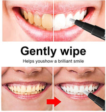 Load image into Gallery viewer, tooth whitening pen uk
