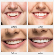 Load image into Gallery viewer, Teeth Whitening Strips