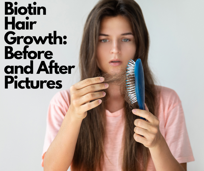 Biotin Hair Growth: Before and After Pictures