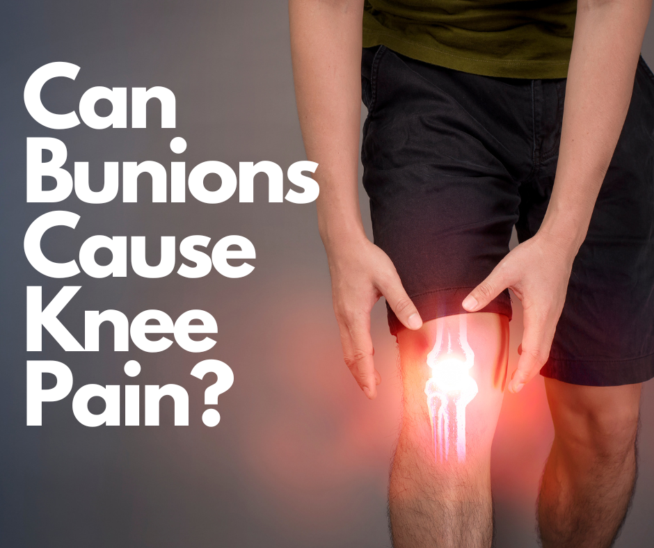 Can Bunions Cause Knee Pain? The Surprising Relationship Between Foot and Joint Health
