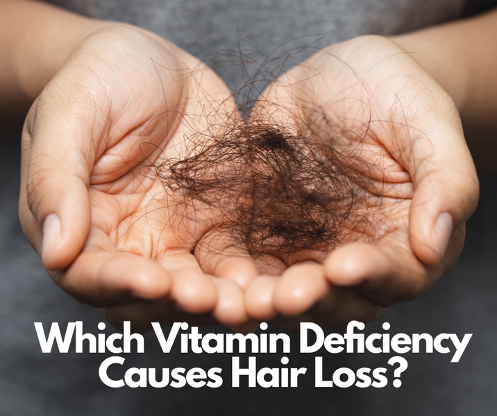 Which Vitamin Deficiency Causes Hair Loss?