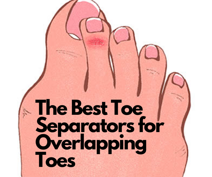 The Best Toe Separators for Overlapping Toes: How to Fix Your Foot Alignment