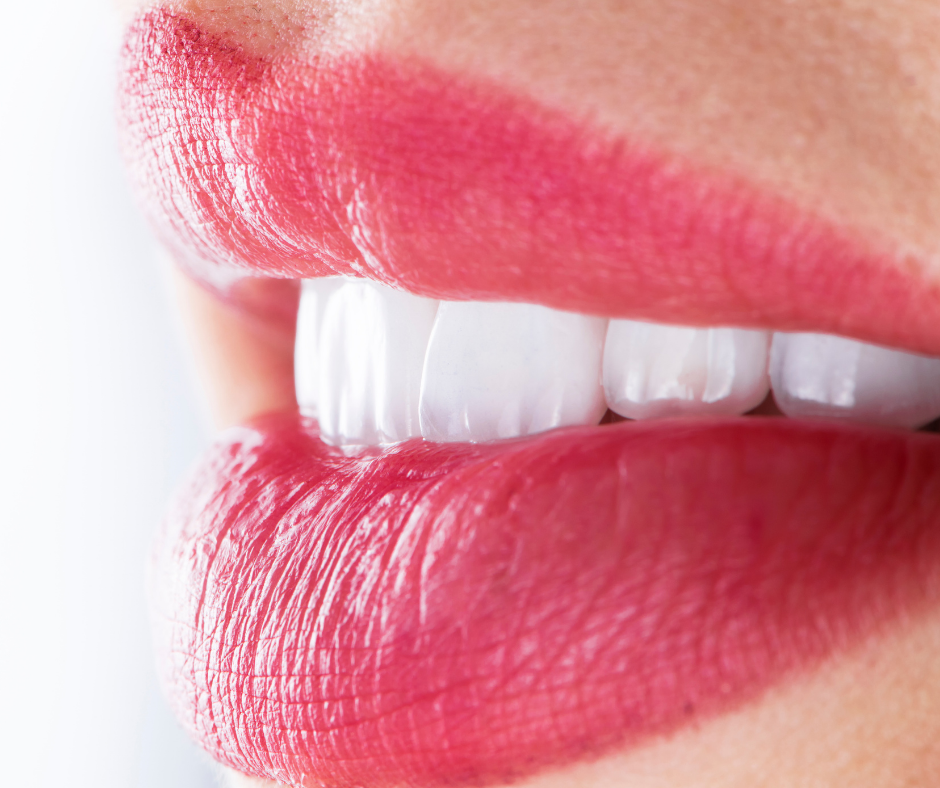 How to Get the Perfect Teeth Before Veneers