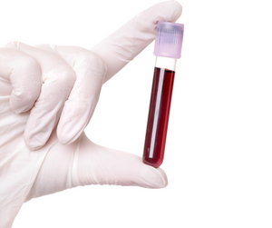 How to Get an Allergy Blood Test: A Guide