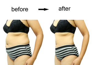 The Best Cellulite Detox Diet: How to Lose Weight and Remove Toxins