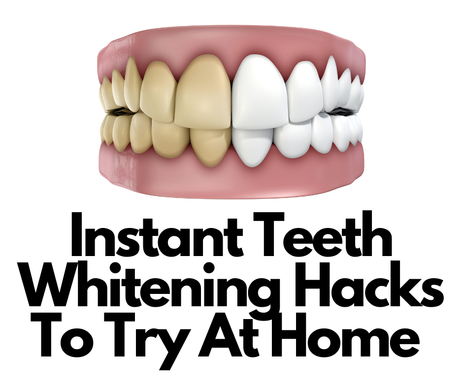 How to Get Rid of Yellow Teeth in 5 Easy Steps