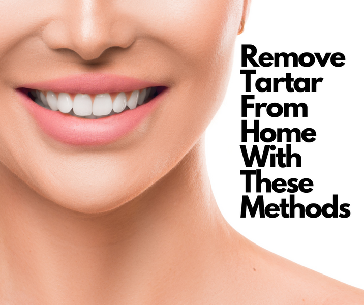 Tartar Removal at Home: The Ultimate Guide