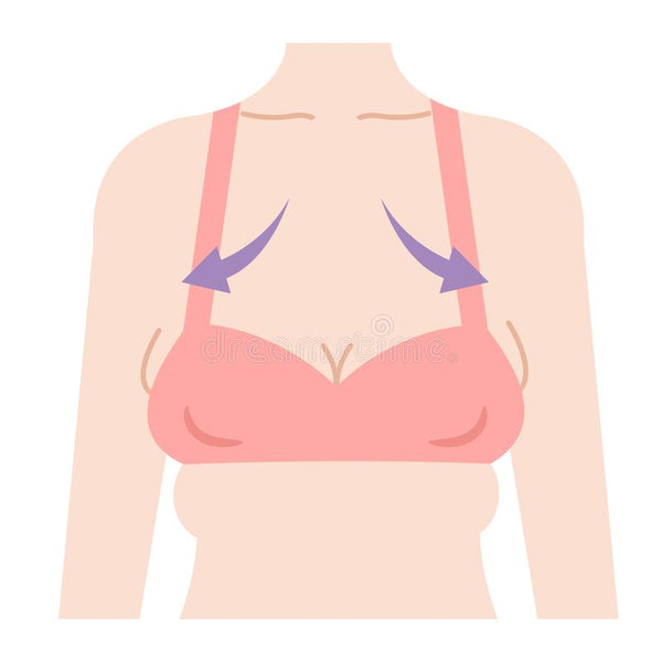 What causes breasts to sag at a young age?
