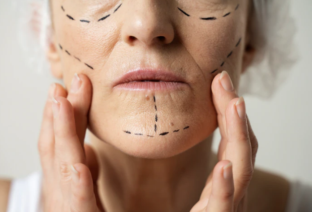 What do the lines on your face mean? A look at facial marks and what they mean
