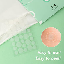 Load image into Gallery viewer, Pimple Patches, Spot Patches, NOACNE Hydrocolloid Patches for Acne Spot Treatment Sticker Anti Blemish Acne Patch 144 Dots
