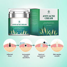 Load image into Gallery viewer, Anti Acne Treatments Cream, Acne Scar Removal Cream, Acne Face Cream, Anti Pimple Cream for Oily Combination or Sensitive Skin of All Ages for All Genders
