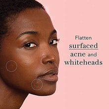 Load image into Gallery viewer, Rael Acne Pimple Healing Patch - Absorbing Cover, Invisible, Blemish Spot, Hydrocolloid, Skin Treatment, Facial Stickers, Two Sizes, Blends in with skin (96 Patches)
