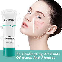Load image into Gallery viewer, Acne Treatment, LANBENA Anti Acne Face Cream, Acne Removal Gel, Acne Pimple Cream Gel, Pimple Treatment Gel Cream, Reduces Redness and Prevent Breakouts（0.7Oz/20g）
