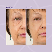 Load image into Gallery viewer, Beverly Hills Instant Facelift - Reduce Fine Lines and Remove Puffiness in 90 Seconds Rapid Reduction of Wrinkles, Instant Lift Eye Serum 30ml / 1oz
