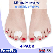 Load image into Gallery viewer, FEETFIX Bunion Corrector Toe Separators – Minimally Invasive Gel Hallux Valgus Big Toe Straightener Protector Splint– Immediate Foot Pain Relief – 4 Pack – Wear with Shoes Spacer –– Medical Grade
