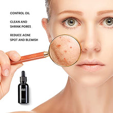 Load image into Gallery viewer, IMIM Acne Treatments Serum Double Strength Spot Blemishes Blackheads Removal Treatment Suitable for Prone to Acne Face Serum for All Skin Types
