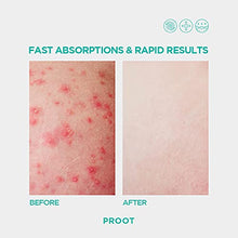 Load image into Gallery viewer, Butt Acne Clearing Spot Treatment Cream. Clears Acne, Pimples, Ingrown Hairs, Blackheads, Zits, Razor Bumps and Dark Spots for the Buttocks and Thigh Area. Prevents Future Breakouts.
