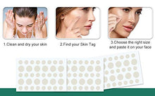 Load image into Gallery viewer, Acne Pimple Master Patches Spot &amp; Blemish Treatment Stickers Invisible Hydrocolloid Patches (216P)
