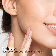 Load image into Gallery viewer, Pimple Patches, Spot Patches, NOACNE Hydrocolloid Patches for Acne Spot Treatment Sticker Anti Blemish Acne Patch 144 Dots
