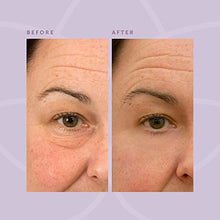 Load image into Gallery viewer, BEVERLY HILLS V-Lift Instant Eye Lift and Eye Tuck Bee Venom Serum for Treating Puffy Eyes, Dark Circles, and Wrinkles
