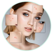 Load image into Gallery viewer, Acne Treatment, GIMGO Acne Scar Removal Serum, Spot Treatment, Cystic Acne Serum for Reduction in Spots,Pimple,Pore Minimizer, Acne Treatment Serum for All Skin of Teen&amp;Women&amp;Men,30ml+30ml (2oz)
