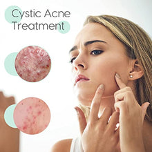 Load image into Gallery viewer, Acne Treatment, GIMGO Acne Scar Removal Serum, Spot Treatment, Cystic Acne Serum for Reduction in Spots,Pimple,Pore Minimizer, Acne Treatment Serum for All Skin of Teen&amp;Women&amp;Men,30ml+30ml (2oz)
