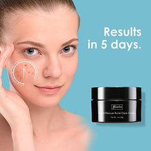 Load image into Gallery viewer, Anti Acne Treatments Cream Bizka for Scars Spots Pimples Treatment Suitable for Oily Combination or Sensitive Skin of All Ages for All Genders,30g
