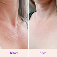 Load image into Gallery viewer, Chest Wrinkle Pads - Anti-Aging Skin Tightening Firming &amp; Moisturizing Fine Lines Prevention - Medical-Grade Silicone Skincare Patch - Reusable Overnight Cleavage &amp; Décolleté Smoother (1-mo Supply)
