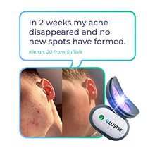 Load image into Gallery viewer, LUSTRE ClearSkin Solo - Blue Light Acne Treatment Device, UV-Free &amp; Wireless | LED Therapy for Face and Body Acne, Spots and Blemishes | Prevent breakouts, inflammation and Skin Redness | No Chemicals
