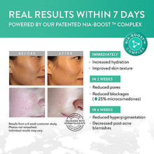 Load image into Gallery viewer, Niacinamide Serum (20%) - 2X More Powerful Anti-Ageing/Brightening Serum + Zinc &amp; Hyaluronic Acid - Reduces Wrinkles/Pores/Hyperpigmentation - Vegan/Dermatologist Approved
