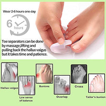 Load image into Gallery viewer, Flared Gel Toe Separators DYKOOK 8 Pieces Big Small Toe Spacers Toe Straighteners for Overlapping Toes and Temporary Bunion Corrector Gel (4 pcs Large + 4 pcs Small)
