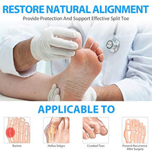 Load image into Gallery viewer, Adepoy Bunion Corrector,Orthopedic Bunion Correctors,Big Toe Separator Pain Relief,for Overlapping Toes,Hallux Valgus Correction,Hammer Toe Straightener,Day Night Support
