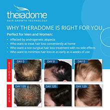 Load image into Gallery viewer, Theradome PRO LH80 Laser Helmet for Hair Loss Treatments in Men and Women. (LH80 PRO), White
