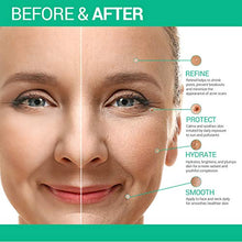 Load image into Gallery viewer, Creip Retinol Cream Moisturiser With Retinol, Anti-aging Wrinkle Night&amp;Day Cream for Face and Eye with 2.5% Retinol, Reduces Wrinkles&amp;Lines&amp;Acne&amp;Aging
