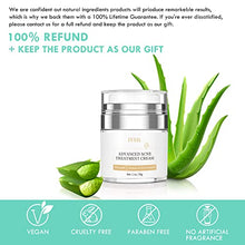 Load image into Gallery viewer, Acne Treatment Cream Ivnil Anti Acne Spot Treatment For Face, Back, Inner Thigh Butt, Anti Acne Cream For Teenagers Suitable For Sensitive Skin Natural Ingredients 30ml
