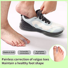 Load image into Gallery viewer, Flared Gel Toe Separators DYKOOK 8 Pieces Big Small Toe Spacers Toe Straighteners for Overlapping Toes and Temporary Bunion Corrector Gel (4 pcs Large + 4 pcs Small)

